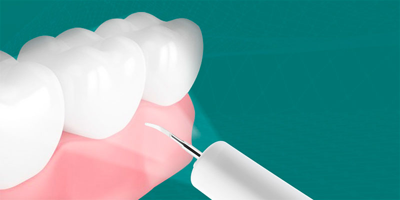 Прибор для удаления зубного камня Dr.Bei Ultrasonic Tooth Cleaner YC2